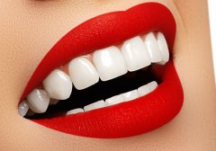 冷光美白牙齒一次有效果嗎，手術多少錢