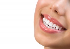 冷光美白牙齒和牙齒貼面哪個好，美白效果保持多久
