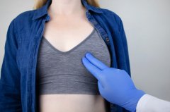 乳房下垂上提手術會留疤嗎，要怎么護理